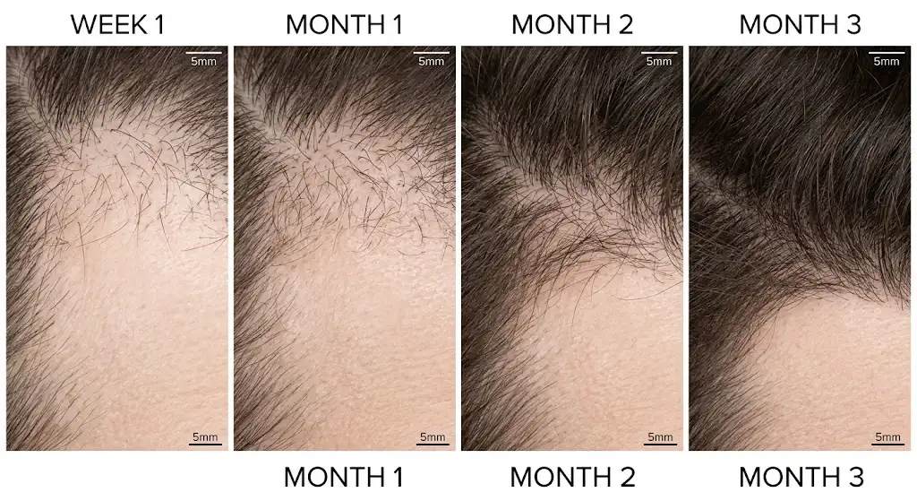 مراحل النمو